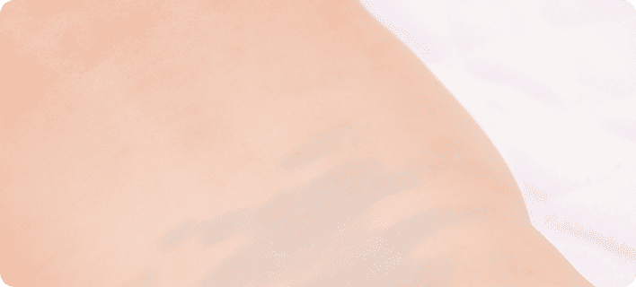 Монголоидные (сакральные) пятна