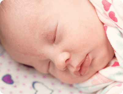 Пятна аиста