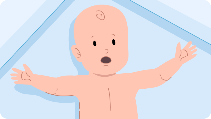 Baby moro reflex 1