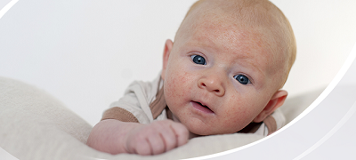 Банальное ФРП или сложная АБКМ: как разобраться в&nbsp;схожих симптомах?