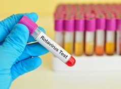 Диагностика и лечение ротавирусной инфекции у детей 